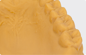 Dental Model Thumb