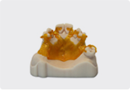 Partial Denture Thumb