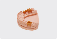 Crown and Bridge Thumb