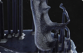 Dental Model Thumb