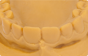 Dental Model Thumb